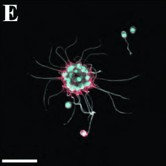 Kleine Kolonie von B. monosierra (Durch­messer 19&nbsp;µm). Balken: 20&nbsp;µm.
