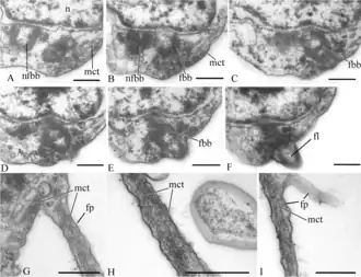 Anordnung der Basalkörper und Struktur der Filopodien[A. 12]