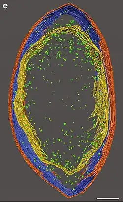 3D-Rekonstruktion dieser Zelle, orange: äußere LML, blau: mittlere LML, gelb: innere LML, grün: Ribosom. Balken jeweils 0,1 μm.