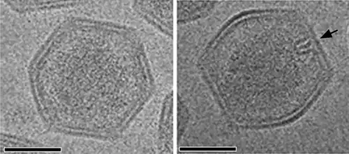Kryo-EM-Aufnahme von reifen SGI-Virionen mit asymmetrischem haarnadel­förmigen Komplex auf der einen Seite (schwarzer Pfeil). Für die Sicht­barkeit ist eine in geeignete Orientierung nötig.