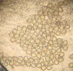 Eipaket innerhalb der Proglottide eines Gurkenkernbandwurmes