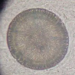 Ei eines Gurkenkernbandwurmes