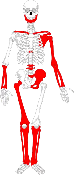 Rot die erhaltenen Knochen der Moorleiche