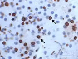 Immunhisto­chemisches Präparat der Bauchspeichel­drüse einer Boa constrictor mit BIBD: EK dunkelrot mit monoklonalen Anti-IBD-Protein-Antikörpern gefärbt (Pfeile), Zellkerne blau gegengefärbt, Balken 20&nbsp;µm (L.-W. Chang et al. 2013).