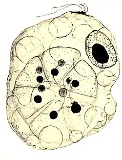 Collodictyon, das eine noch lebende kleine Pandorina-Kolonie verschluckt hat[5]