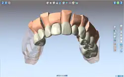 DentCAM