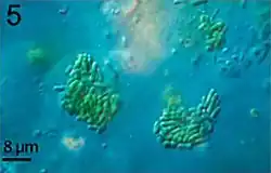 Mikroskopische Aufnahme von Synechococcus sp.