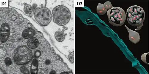 Vesikel, die vollständig umhüllte Virionen enthalten. Balken 500&nbsp;nm.