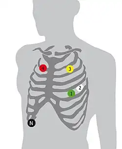 Applikation der Elektroden