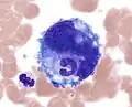 Neutrophiler Granulozyt in einer Megakaryozyte