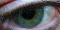 blaugrünes Auge mit zentraler Heterochromie