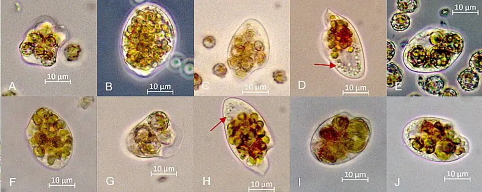 O. marina mit calcifizierte bzw. decalcifizierter Coccolithophyceae-Beute (A, B und C, D: Gephyrocapsa huxleyi; E, F und G, H: G. oceanica; I, J: Pleurochrysis carterae)[7]