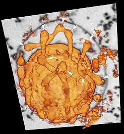 Zytoplasmatische Ausstülpungen von I.&nbsp;hospitalis