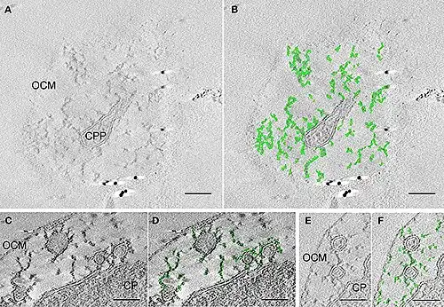 Matrix aus Filamenten bzw. Verbindungen (engl. thethers) im Intermembrankompartiment (IMC)