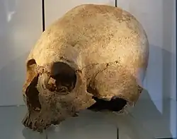 Künstlich deformierter Schädel ( 500.n. Chr. ) eines Hunnen/Ostgermanen, aus einem Grab in Regensburg-Irlmauth