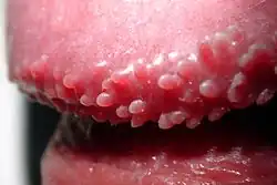 Eichelrand mit Hornzipfelchen