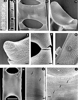 Eucampia zodiacus f. recta