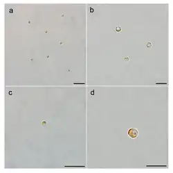 LM-Aufnahmen von A.&nbsp;anophagefferens Stamm CCMP1984: RSC und vegetative Zellen (VCs); Balken 10&nbsp;µm.[1]