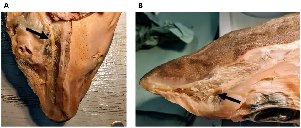 Kopfbereich eines Dornhais (Squalus acanthias) mit abgezogener Haut. A, Ansicht von unten; zu erkennen ist der Ramus buccalis des vorderen Lateralisnervs (Pfeil) und die von ihm abgehenden Nervenfaserbündel, die zu den Lorenzinischen Ampullen ziehen. Diese wurden auf der linken Seite des Fotos, zusammen mit der Haut, abpräpariert. Auf der rechten Seite des Fotos ist das ventrale Porenfeld noch gut zu erkennen. B, Ansicht von oben; zu erkennen ist der Ramus superficialis ophthalmicus des vorderen Lateralisnervs (Pfeil) und die von ihm abgehenden Nervenfaserbündel, die zu den Lorenzinischen Ampullen des dorsalen Ampullenfelds ziehen.