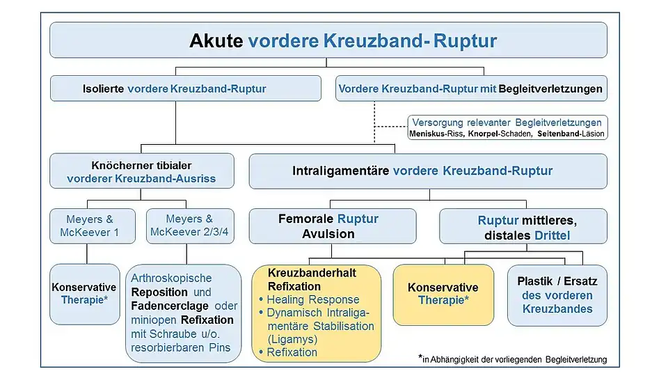 Schema Optionen bei akuten vorderen Kreuzband-Rupturen