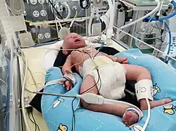 Lungensimulator LuSi