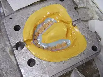 Prothesenzähne in der Küvette nach dem Wachsausschmelzen