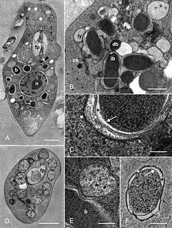 TEM-Aufnahmen von N.&nbsp;esmeraldas und „Ca.&nbsp;P.&nbsp;novymonadis“