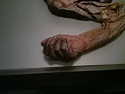 Arm des Old-Croghan-Mannes