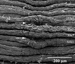 Rasterelektronenmikroskopische Aufnahme der Gonoporen eines Plattegels