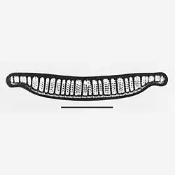 E. adnata var. porcellus [E.&nbsp;zebra var. porcellus]. Balken:&nbsp;25&nbsp;µm.