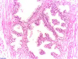 Normales Prostatagewebe