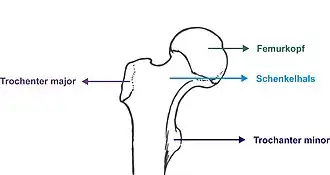 Schenkelhals und Femurkopf