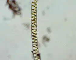 Spirogyra im Hellfeld