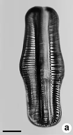 R. gibba vom Ein­zugs­gebiet des Río Cali (englisch Cali River), Kolumbien. Balken 10&nbsp;µm.