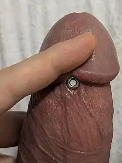 Schaft-Apadravya mit Barbell (links) und mit 6 gauge Tunnel (rechts)