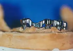 Suprakonstruktion - die zylinderförmigen Teile sind vorgefertigt.