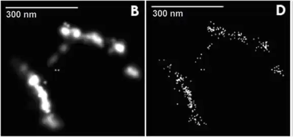 Tabakmosaikvirus (Super-Resolution Mikroskop-Aufnahme)