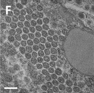 TEM-Aufnahme neugebildeter reifer Sputnik-Virionen.[8]