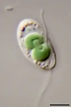 Dito, aber nur 1 Cyanelle in Teilung. Balken: 5 µm (W. Bettighofer)