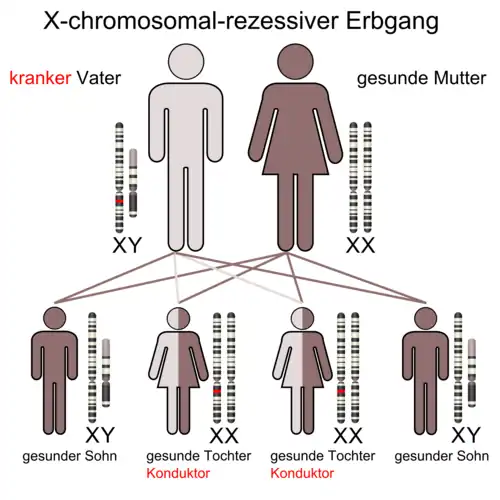 X-chromosomal durch den Vater vererbtes Merkmal. Alle Töchter besitzen ein rezessives Allel, ohne selbst betroffen zu sein – d.&nbsp;h. sie sind gesund, können aber diese Anlage weitergeben (siehe X-chromosomal durch die Mutter vererbtes, rezessives Merkmal).