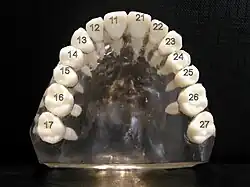Zahnmodell mit FDI-Zahnschema Oberkiefer (ohne Weisheitszähne)