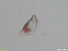 Cyphoderia calceola [C.&nbsp;calceolus]