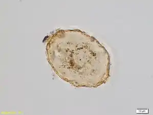 Amphitrema stenostoma, Mikrophotographie