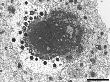 „Sputnik&nbsp;3“-Virophagen, produziert in einer VF von Courdo11 (Spezies Megavirus chilensis, Gruppe C-Mimiviren). Balken 2&nbsp;µm.[5]